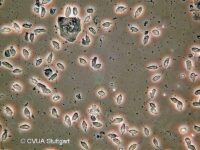 Trichomonaden unter dem Mikroskop Trichomonaden unter dem Mikroskop